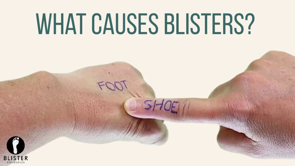 What Are The Causes Of Blisterata?
