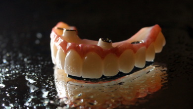 What Are the Options for Customizing the Fit and Appearance of Home Dentures