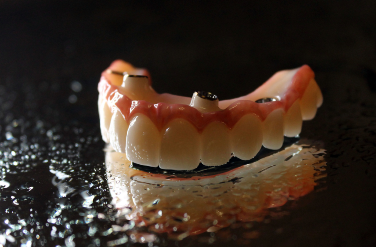 What Are the Options for Customizing the Fit and Appearance of Home Dentures