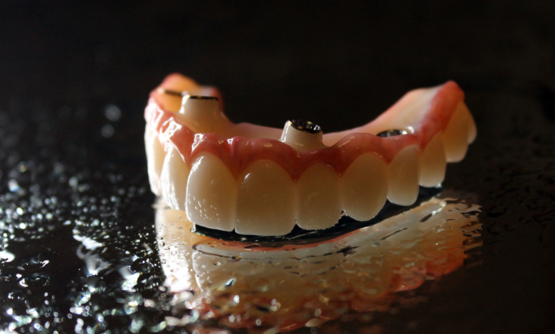 What Are the Options for Customizing the Fit and Appearance of Home Dentures