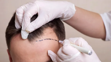 Customizing Your Treatment for a Scalp Tattoo